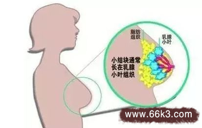 墙裂推荐（治疗乳腺增生的偏方大全,效果）治疗乳腺增生的小偏方，得了乳腺增生怎么办 治疗乳腺增生八个偏方，